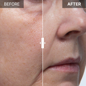 Stem Cell Culture Medium Ampoule 10% Franz Skincare USA