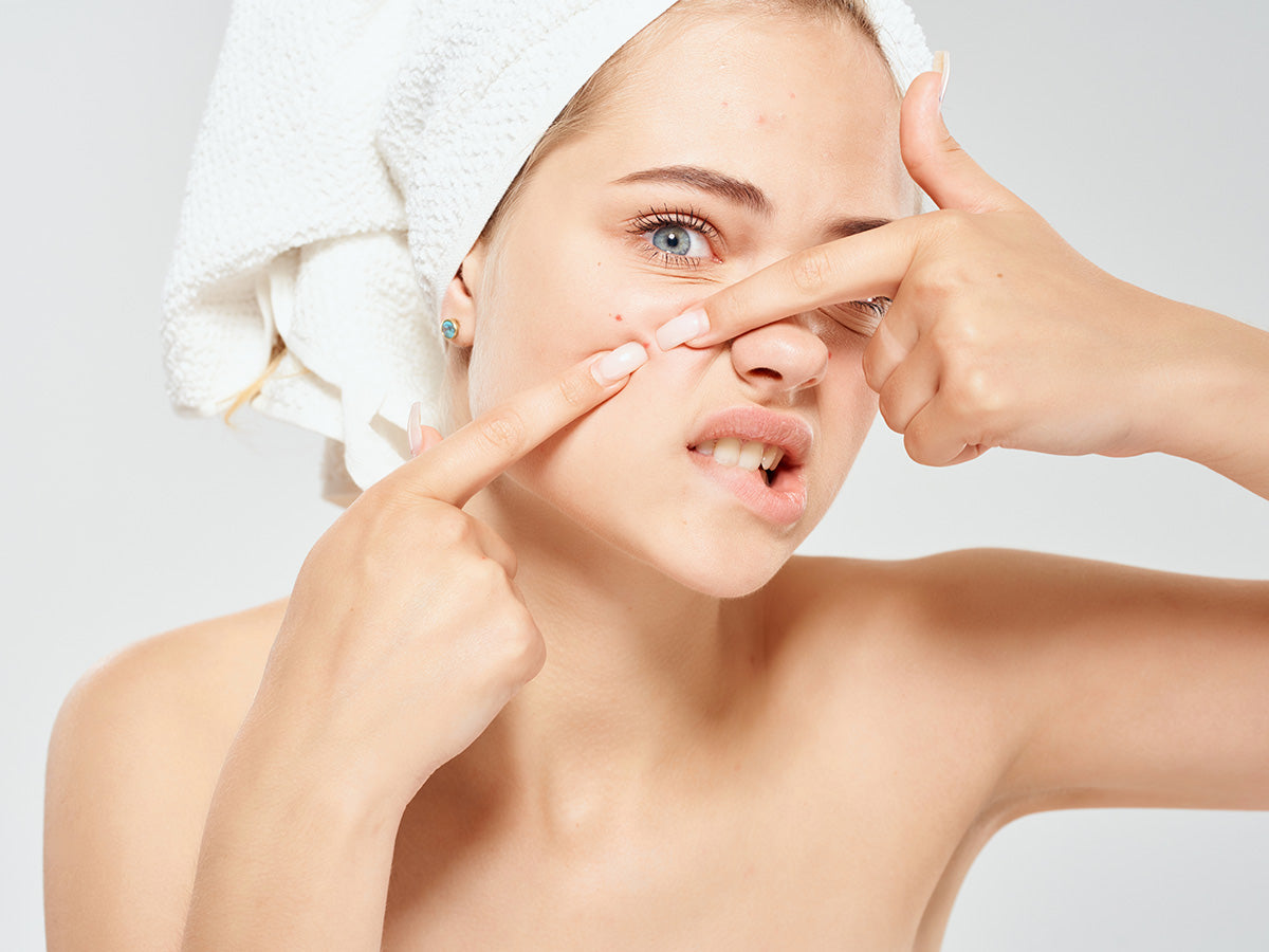 Here's What May Be Responsible  For Your Adult Acne - Franz Skincare USA