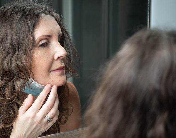 What Is Maskne and How to Treat Face Mask Acne Breakouts - Franz Skincare USA