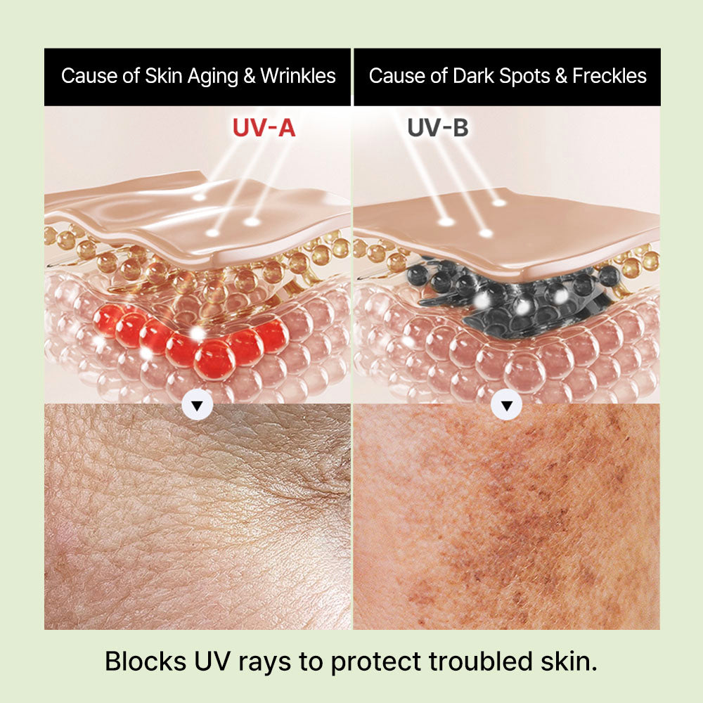 Naked Spot Patch 3 set Franz Skincare USA