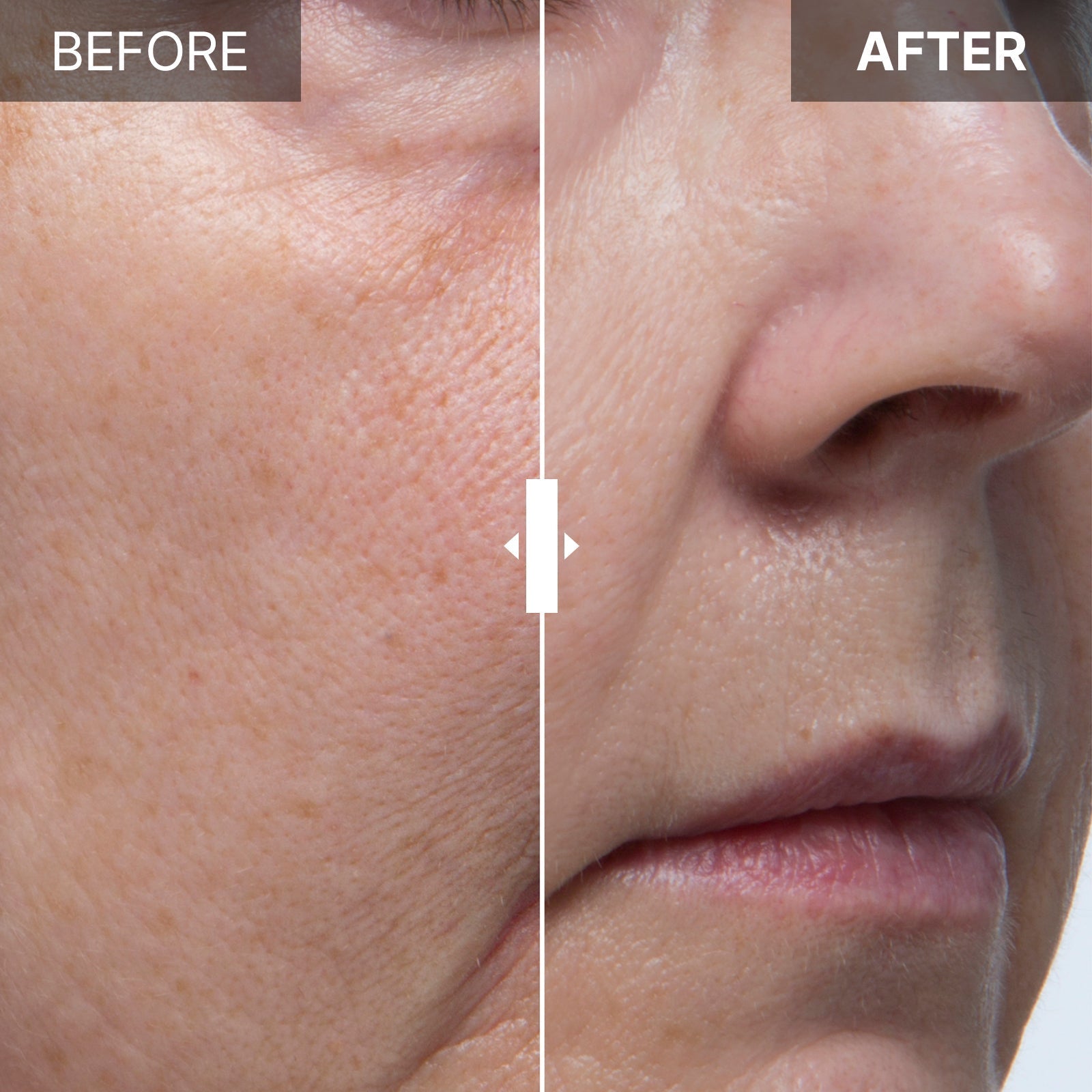 Stem Cell Culture Medium Ampoule 10% Franz Skincare USA
