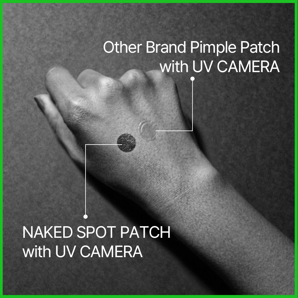 Blemish Recovery Naked Spot Patch Franz Skincare USA