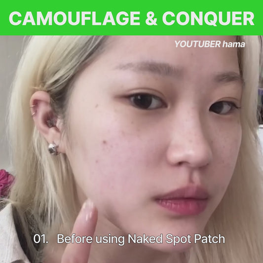 [UP TO 50% OFF] FRANZ Dark Spot Patch (72 EA)